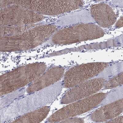 Immunohistochemistry-Paraffin: Fast skeletal myosin light chain 2 Antibody [NBP2-62625]