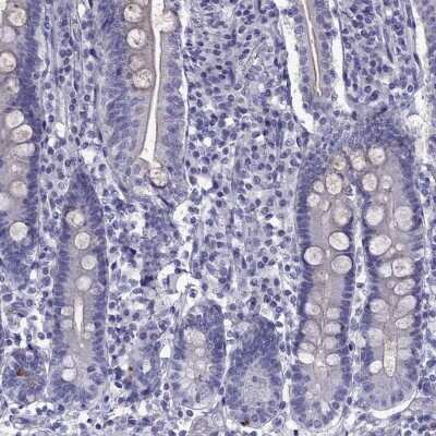 Immunohistochemistry-Paraffin: Fast skeletal myosin light chain 2 Antibody [NBP2-62625]