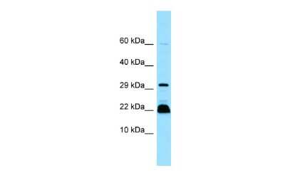 Western Blot: Fast skeletal myosin light chain 2 Antibody [NBP2-84926]