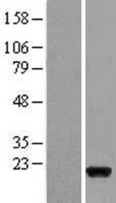 Western Blot: Fast skeletal myosin light chain 2 Overexpression Lysate [NBL1-13433]