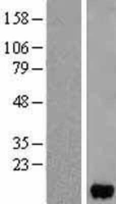 Western Blot: FABP5/E-FABP Overexpression Lysate [NBL1-10421]