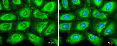 Immunocytochemistry/ Immunofluorescence: Fatty Acid Synthase/FASN Antibody (325) [NBP2-43822]