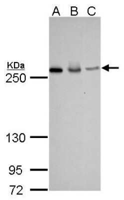 Western Blot: Fatty Acid Synthase/FASN Antibody (325) [NBP2-43822]