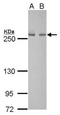 Western Blot: Fatty Acid Synthase/FASN Antibody (325) [NBP2-43822]