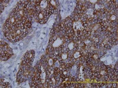 Immunohistochemistry-Paraffin: Fatty Acid Synthase/FASN Antibody (3F2-1F3) [H00002194-M01]