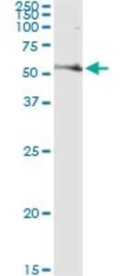 Immunoprecipitation: Fatty Acid Synthase/FASN Antibody (3F2-1F3) [H00002194-M01]