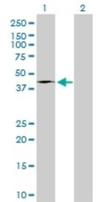 Western Blot: Fatty Acid Synthase/FASN Antibody (3F2-1F3) [H00002194-M01]