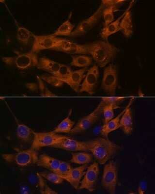 Immunocytochemistry/ Immunofluorescence: Fatty Acid Synthase/FASN Antibody (4U9S3) [NBP3-15634]