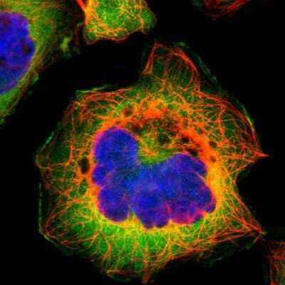 Immunocytochemistry/ Immunofluorescence: Fatty Acid Synthase/FASN Antibody [NBP1-84733]