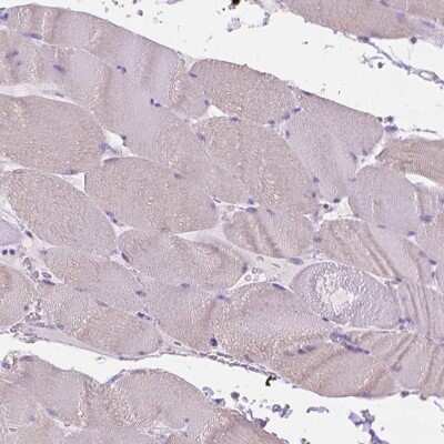 Immunohistochemistry-Paraffin: Fatty Acid Synthase/FASN Antibody [NBP1-84733]