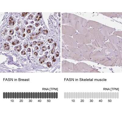 Immunohistochemistry-Paraffin: Fatty Acid Synthase/FASN Antibody [NBP1-84733]