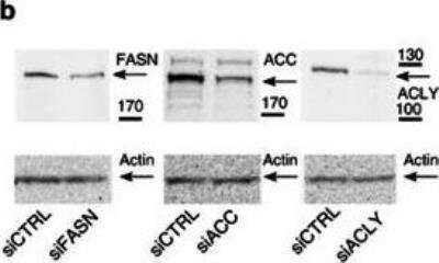 Knockdown Validated: Fatty Acid Synthase/FASN Antibody [NB400-114]