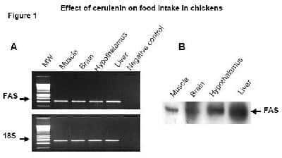 Western Blot: Fatty Acid Synthase/FASN Antibody [NB400-114]