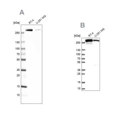 Western Blot: Fatty Acid Synthase/FASN Antibody [NBP1-84733]