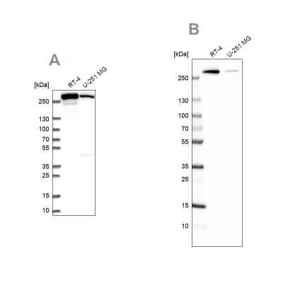 Western Blot: Fatty Acid Synthase/FASN Antibody [NBP2-49213]