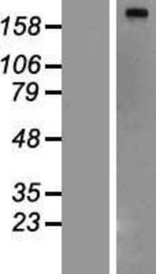 Western Blot: Fatty Acid Synthase/FASN Overexpression Lysate [NBP2-10566]