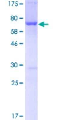 SDS-PAGE: Recombinant Human Fatty Acid Synthase/FASN GST (N-Term) Protein [H00002194-P01]