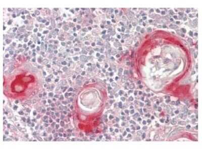 Immunohistochemistry-Paraffin: Fatty acid desaturase 2 Antibody [NBP2-82734]