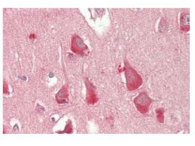 Immunohistochemistry-Paraffin: Fatty acid desaturase 2 Antibody [NBP2-82734]