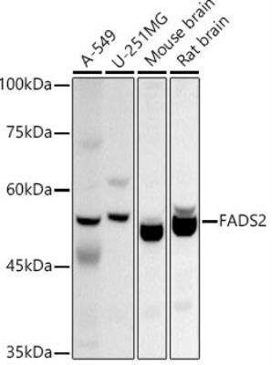 Western Blot: Fatty acid desaturase 2 AntibodyAzide and BSA Free [NBP3-03260]