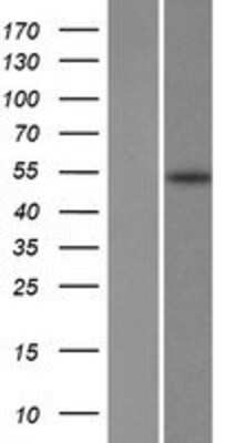 Western Blot: Fatty acid desaturase 2 Overexpression Lysate [NBP2-10570]