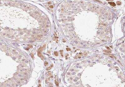 Immunohistochemistry-Paraffin: Fbl14 Antibody [NBP2-33296]