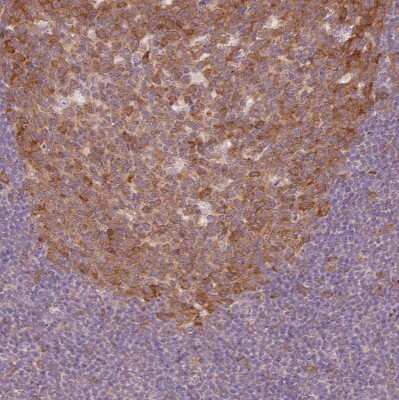 Immunohistochemistry-Paraffin: Fbl14 Antibody [NBP2-33296]