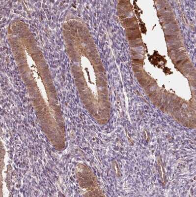 Immunohistochemistry-Paraffin: Fbl14 Antibody [NBP2-33296]