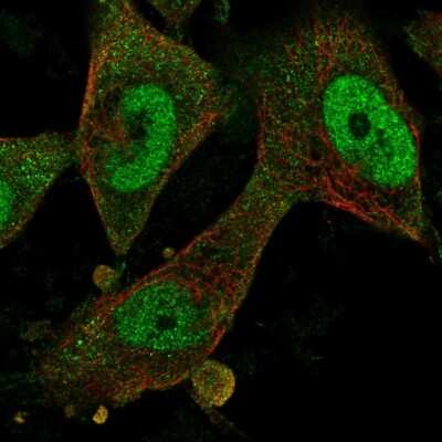 Immunocytochemistry/ Immunofluorescence: Fbx32 Antibody [NBP2-57070]