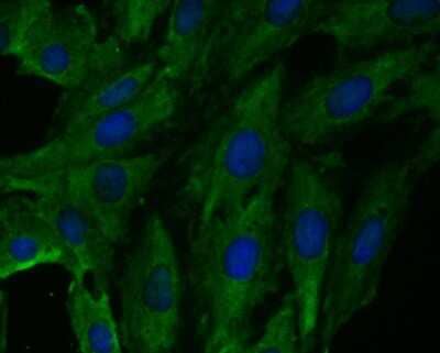 Immunocytochemistry/ Immunofluorescence: Fbx32 Antibody (JE41-27) [NBP2-76836]