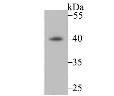 Western Blot: Fbx32 Antibody (JE41-27) [NBP2-76836]