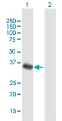 Western Blot: Fbx32 Antibody [H00114907-B01P]