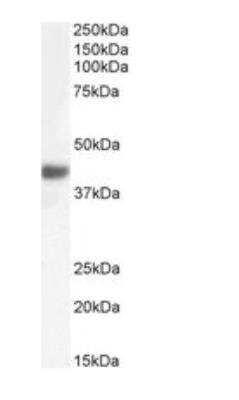 Western Blot: Fbx32 Antibody [NBP1-36955]