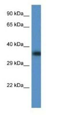 Western Blot: Fbx32 Antibody [NBP1-79517]