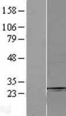 Western Blot: Fbx32 Overexpression Lysate [NBL1-10632]