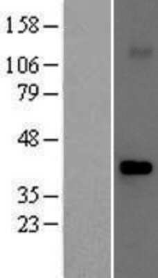 Western Blot: Fbx32 Overexpression Lysate [NBP2-05797]