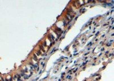 Immunohistochemistry-Paraffin: FbxL12 Antibody [NB100-1295]