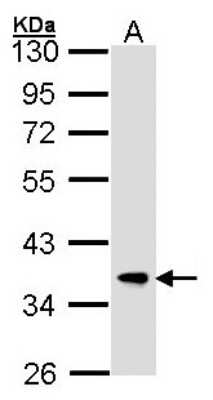 Western Blot: FbxL12 Antibody [NBP1-31021]