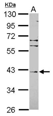 Western Blot: Fbxl8 Antibody [NBP2-16444]