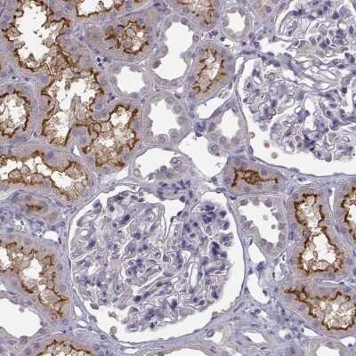 Immunohistochemistry-Paraffin: FCAMR Antibody [NBP2-62627]