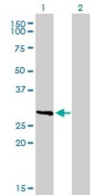 Western Blot: Fc epsilon RI Antibody (2C12-3B6) [H00002205-M01]