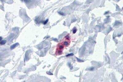 Immunohistochemistry-Paraffin: Fc epsilon RI Antibody (AER-37) - BSA Free [NBP1-43278]