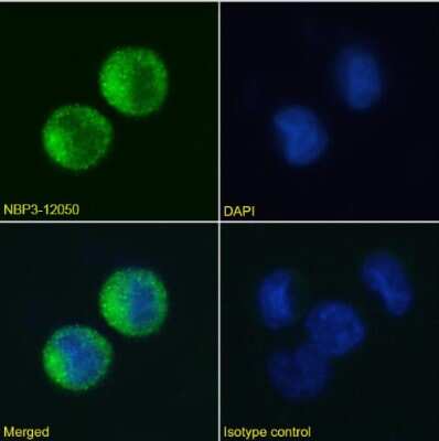 Immunocytochemistry/ Immunofluorescence: Fc epsilon RI Antibody (IB10) - Chimeric - Azide and BSA Free [NBP3-12050]