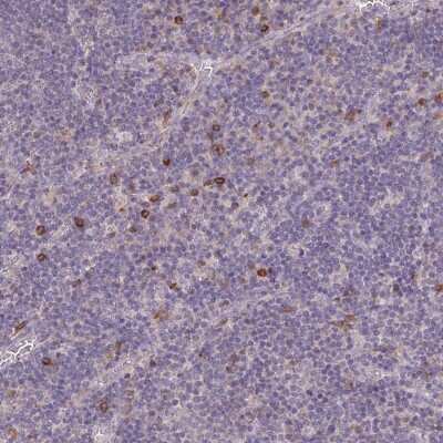 Immunohistochemistry-Paraffin: Fc epsilon RI Antibody [NBP2-54974]