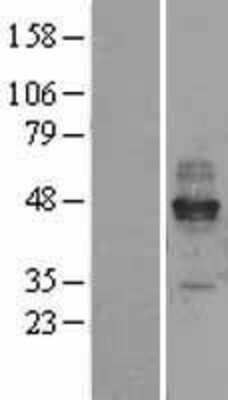 Western Blot: Fc epsilon RI Overexpression Lysate [NBL1-10650]