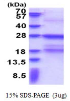 SDS-PAGE: Recombinant Human Fc epsilon RI His Protein [NBP2-23043]