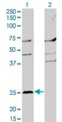 Western Blot: Fc epsilon RI beta/MS4A2 Antibody (3B1) [H00002206-M02]