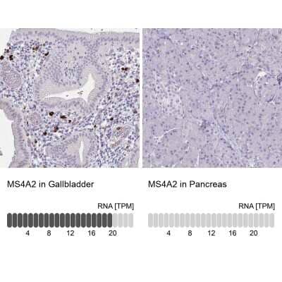 Immunohistochemistry-Paraffin: Fc epsilon RI beta/MS4A2 Antibody [NBP2-31807]
