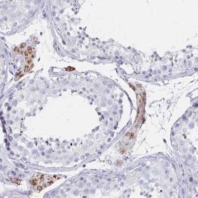 Immunohistochemistry-Paraffin: Fc epsilon RI beta/MS4A2 Antibody [NBP2-31807]