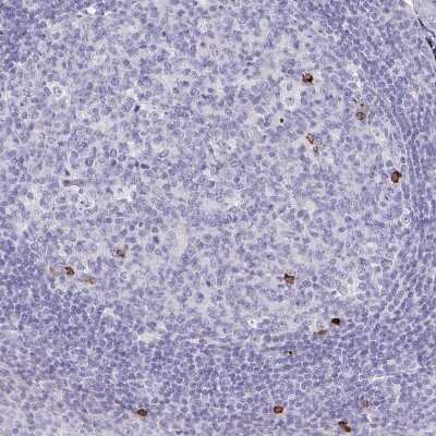 Immunohistochemistry-Paraffin: Fc epsilon RI beta/MS4A2 Antibody [NBP2-31807]